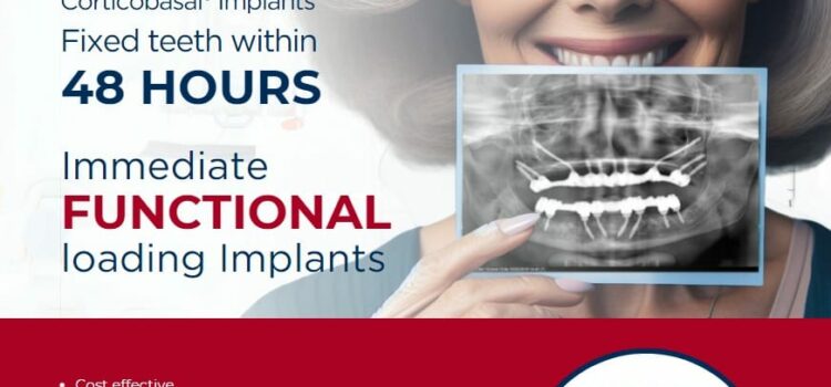 Discover the Power of Simpladent: A Network of Clinics Bringing World Class Dental Implant Within Reach