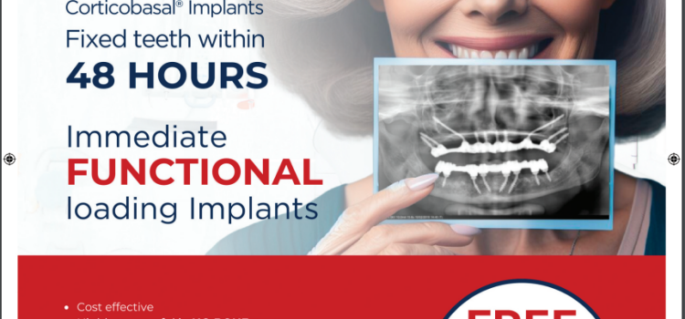 Say Goodbye to Waiting: Simpladent’s Immediate Loading Implants Offer Instant Results