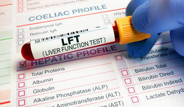 When Should You Get Liver Function Tests Done? Signs and Symptoms that Warrant Testing