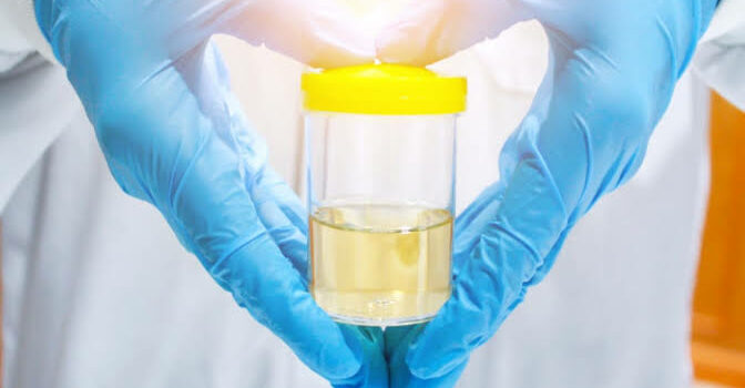 What Does a Complete Urine Examination Involve? A Step-by-step Overview