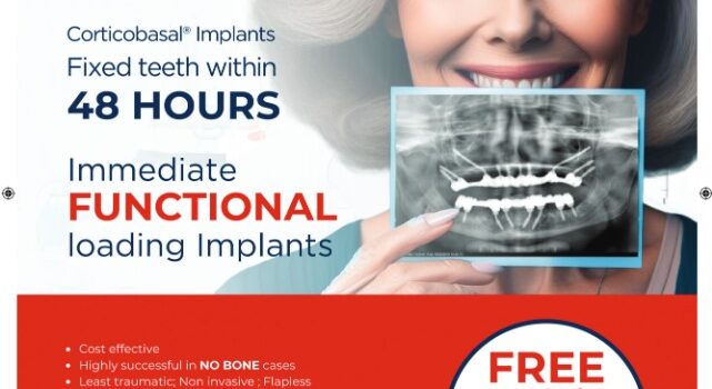 5 REASONS WHY SIMPLADENT IMMEDIATE LOADING DENTAL IMPLANTS ARE SO POPULAR
