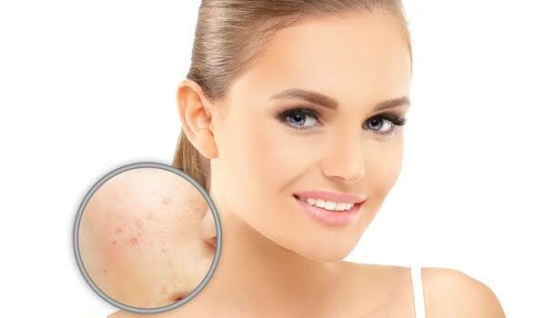 How to Reduce Skin Pigmentation?