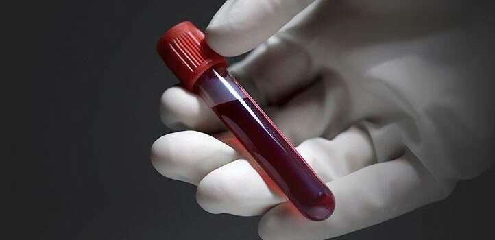 Which Blood Test Can Help Detect Infections?