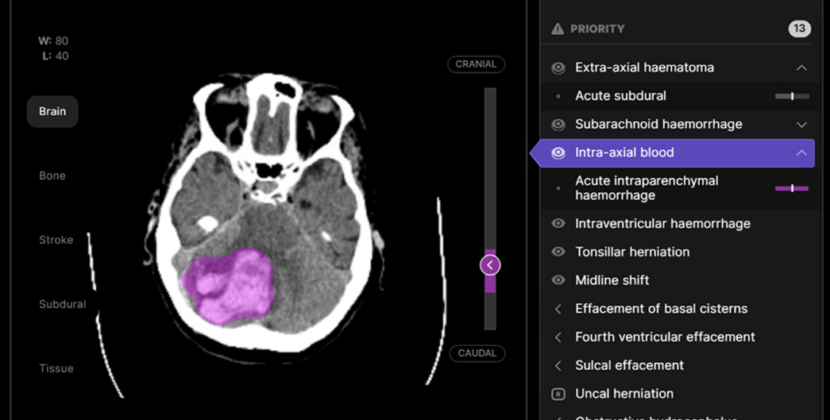 Aarthi Scans adopts Australian AI technology to elevate patient care management