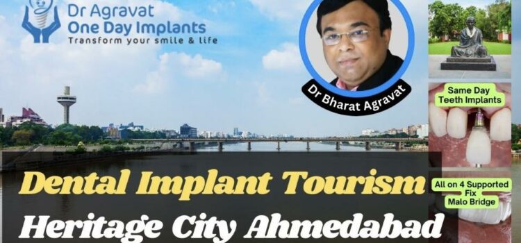 Dr Agravat Dental Implants Tourism Grows and Booms in the Indias First Heritage City Ahmedabad.