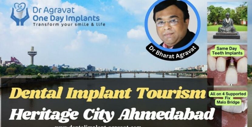 Dr Agravat Dental Implants Tourism Grows and Booms in the Indias First Heritage City Ahmedabad.