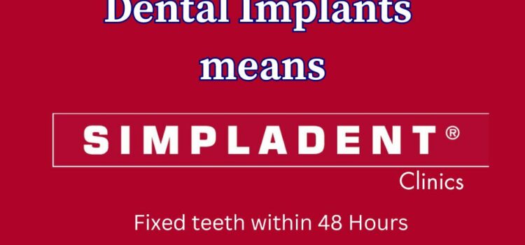 Why Choose Immediate Loading Dental Implants Over Traditional Implants?