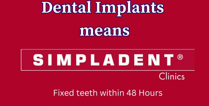 Why Choose Immediate Loading Dental Implants Over Traditional Implants?