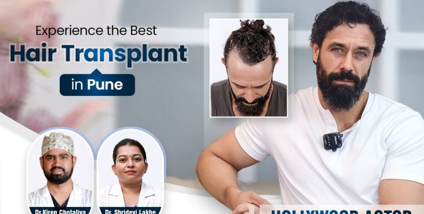 Title: HairFree & HairGrow Leads as Pune’s #1 Choice for Hair Transplants with 100% Success Rate