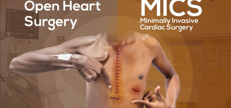 Transforming Heart Care: A Traveler’s Guide to Minimally Invasive Cardiac Surgery
