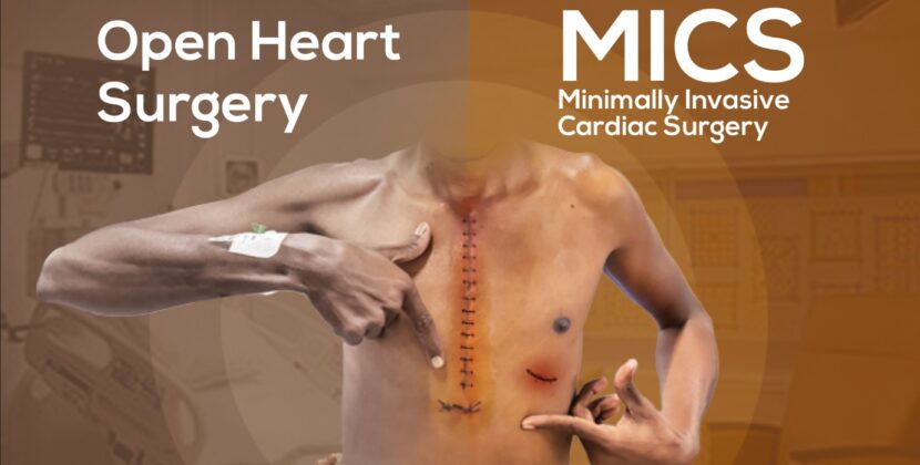 Transforming Heart Care: A Traveler’s Guide to Minimally Invasive Cardiac Surgery